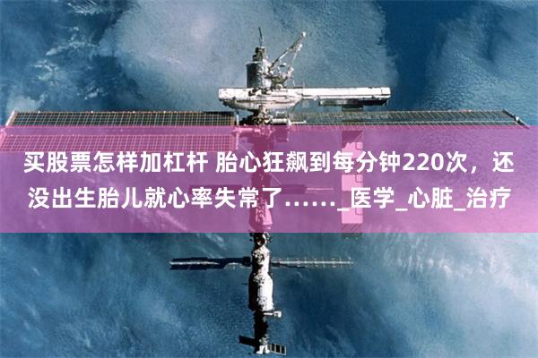 买股票怎样加杠杆 胎心狂飙到每分钟220次，还没出生胎儿就心率失常了……_医学_心脏_治疗